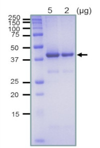 RecA (protein, positive control) in the group Antibodies, Bacterial/Fungal at Agrisera AB (Antibodies for research) (AS21 4542P)